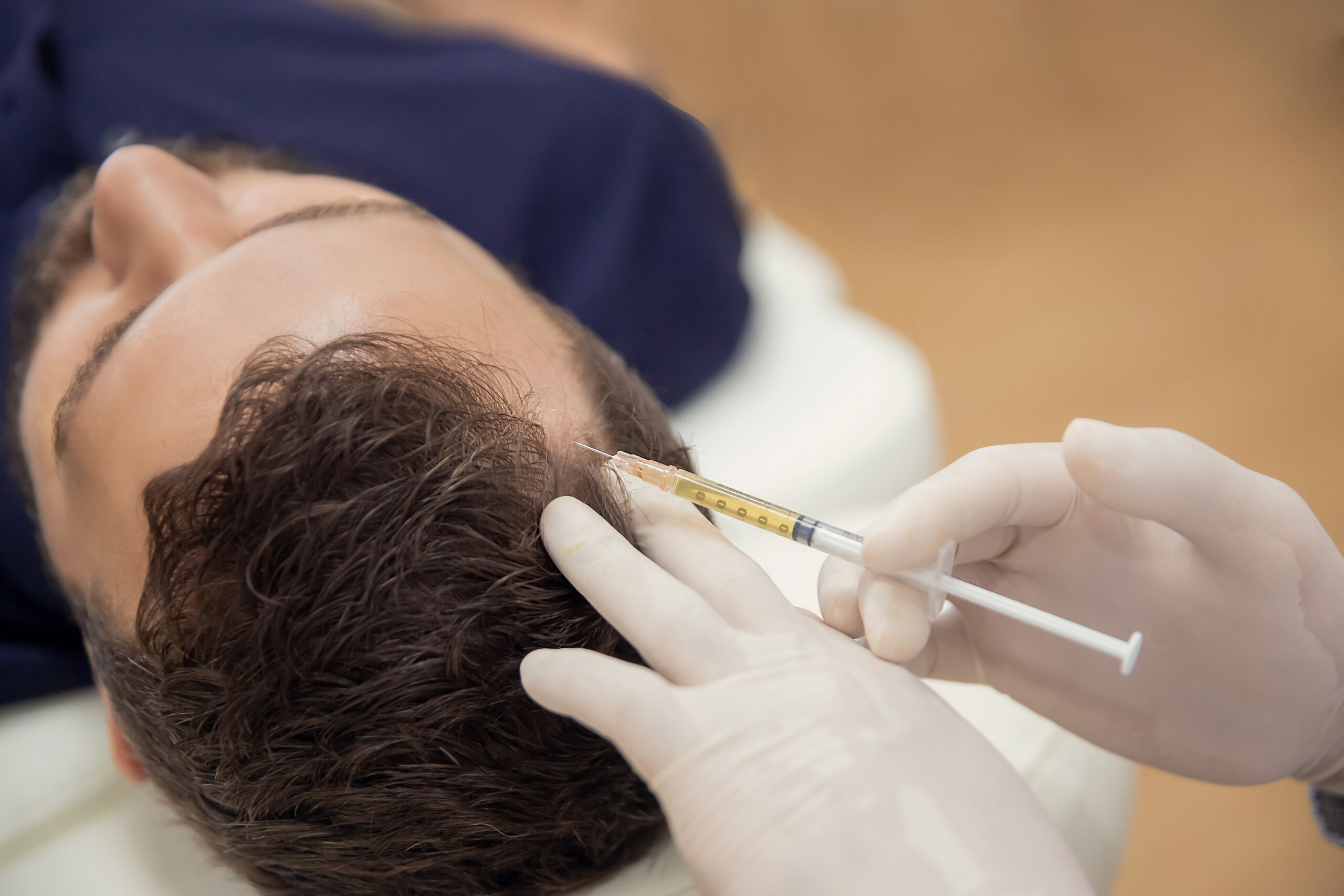 Hair mesotherapy or scalp prp: Platelet-rich plasma procedure. Beautician doctor makes injections in the man head for hair growth against hair loss and baldness (Hair mesotherapy or scalp prp: Platelet-rich plasma procedure. Beautician doctor makes in